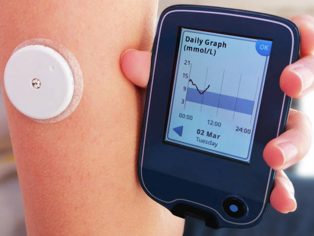 Continuous Glucose Monitoring with Consultation