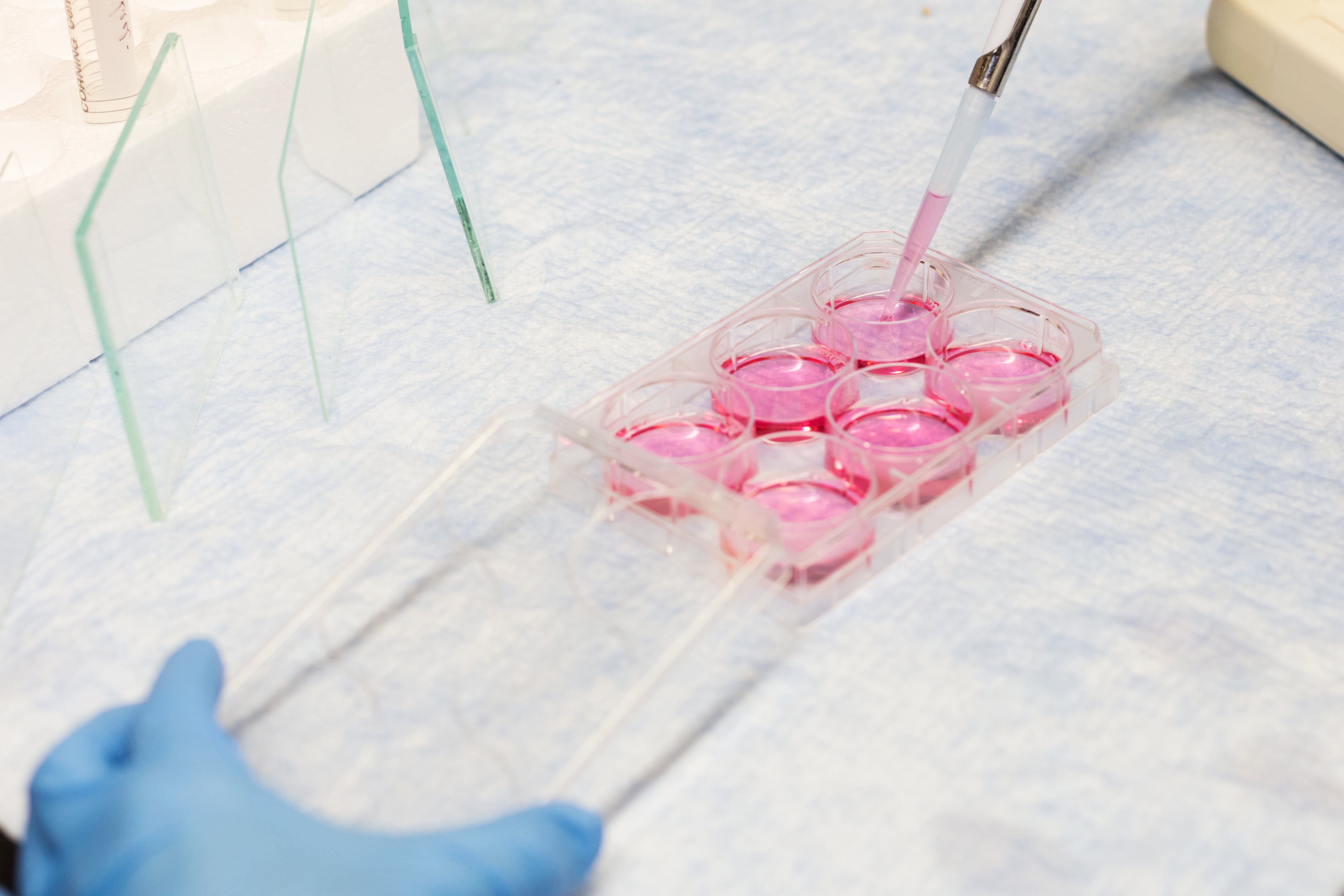 Complete Blood Count Lab (CBC) – Avant Pharmacy & Wellness